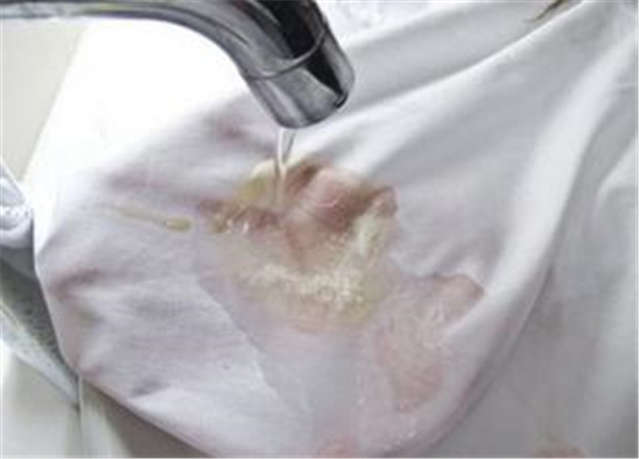 如何除衣物上霉漬